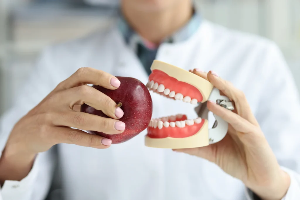 Dental model biting an apple, symbolizing healthy food choices for oral health in Monett, MO