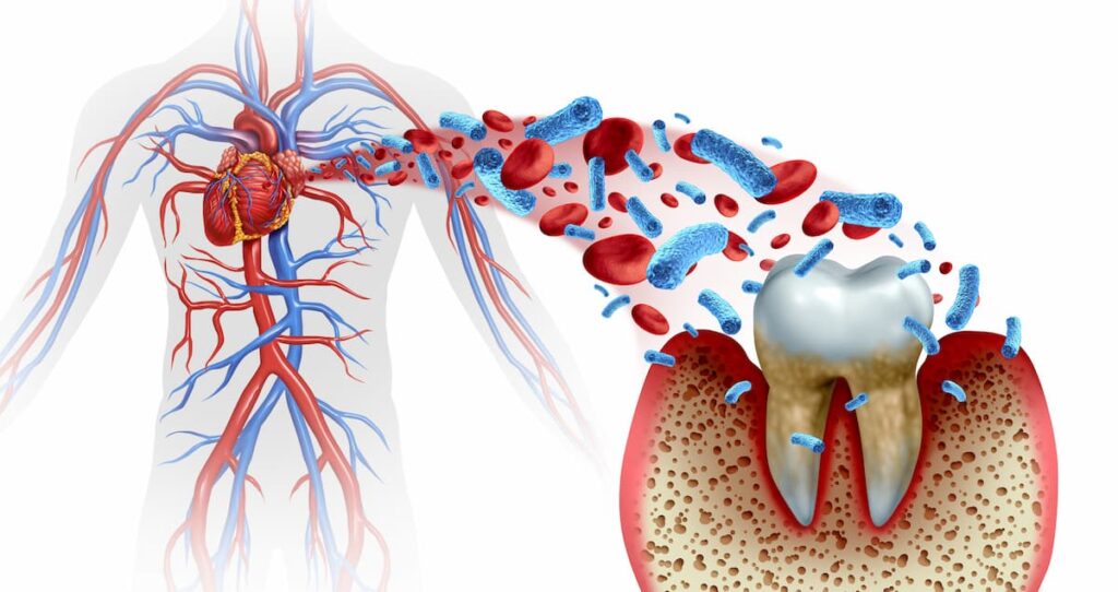 Illustration showing the link between dental health & cardiovascular health in Fenton, MO
